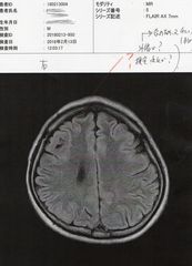 謎の脳みその空間?.jpg